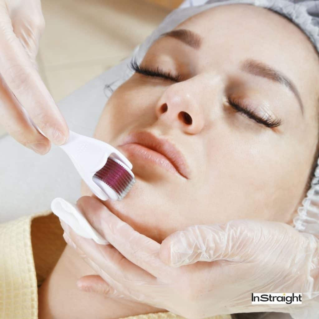 pretty lady getting derma roller treatment